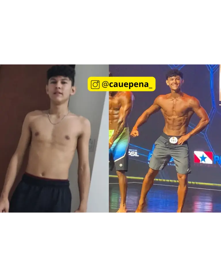 Caue Pena, paciente do Dr. Victor Duarte: Atleta de Fisiculturismo